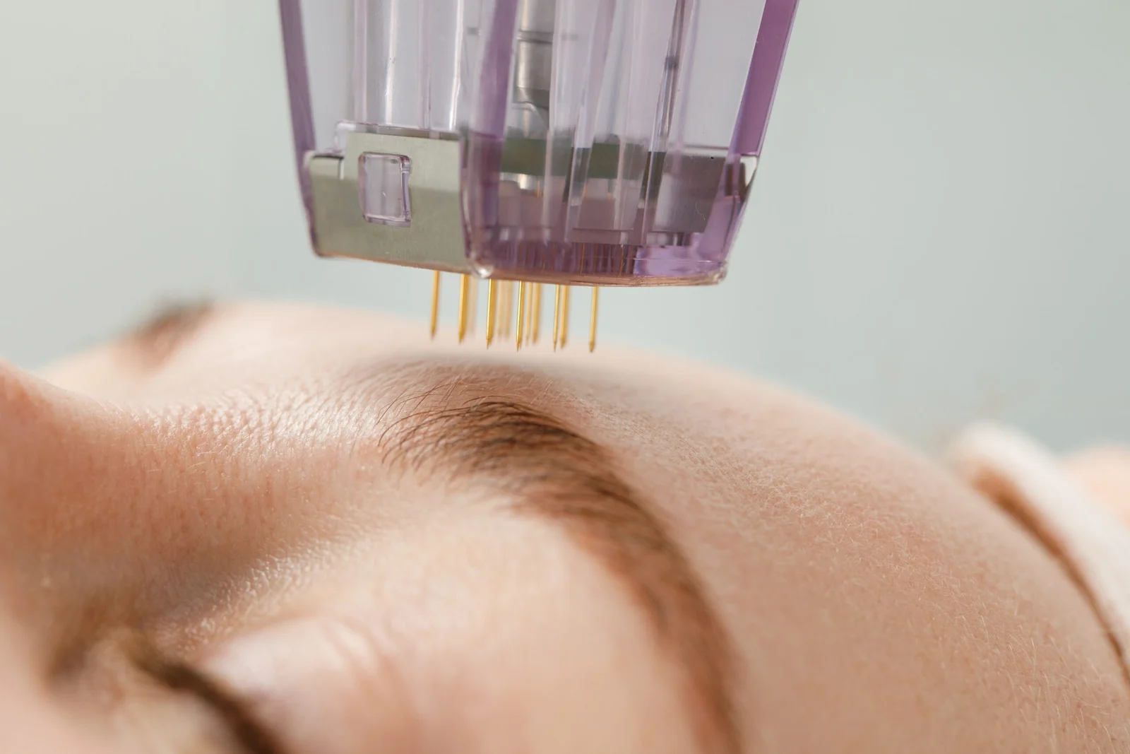 Microneedling — Derma Pen