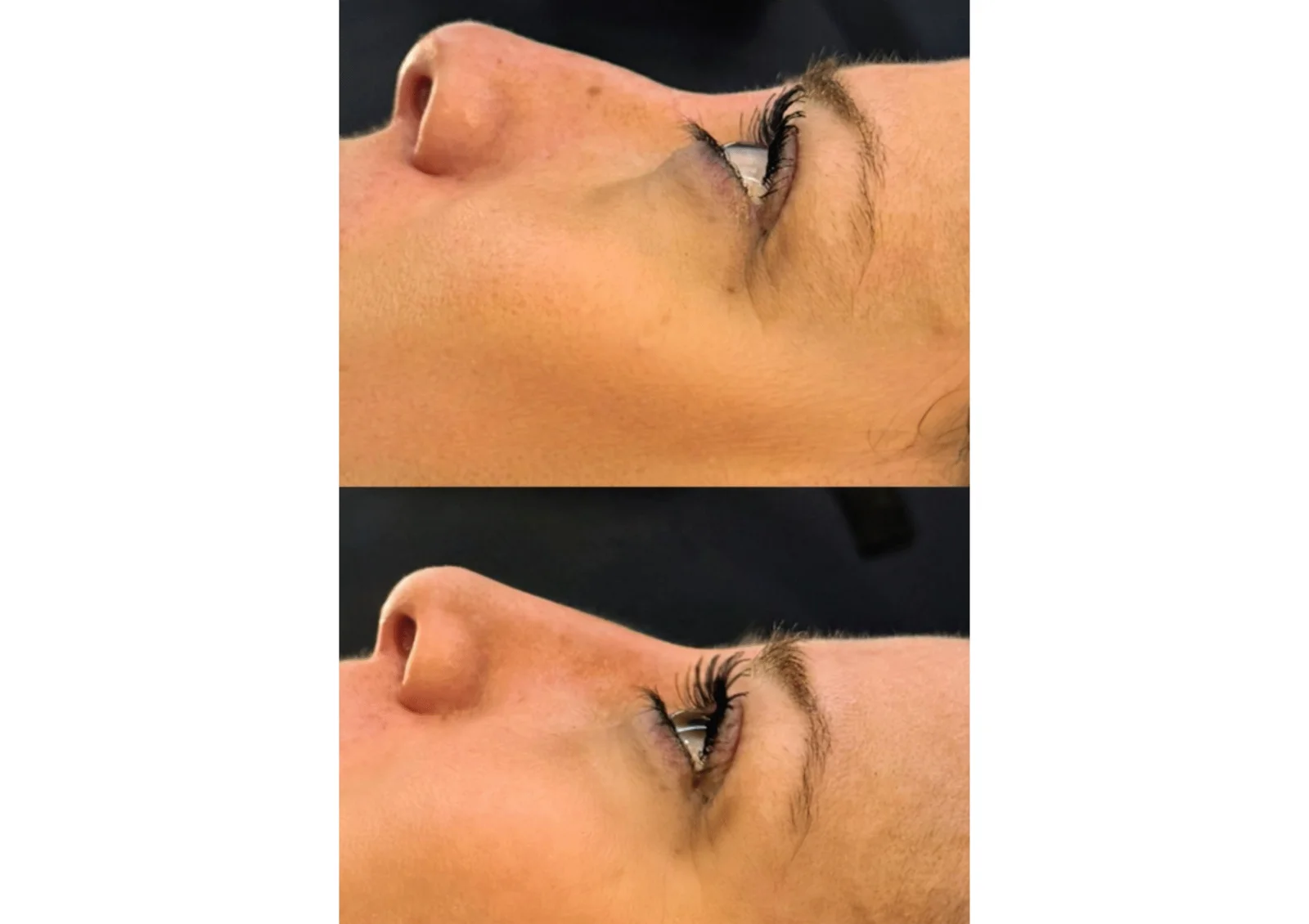 Before and after result 1