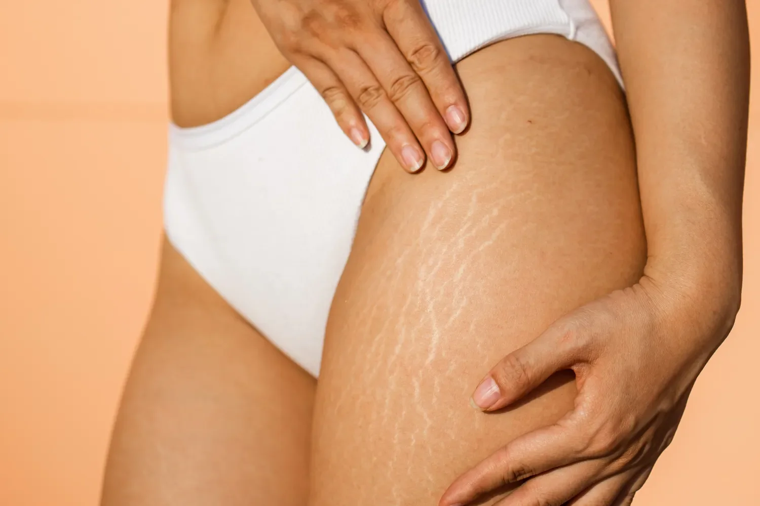 Advanced body refinement treatment