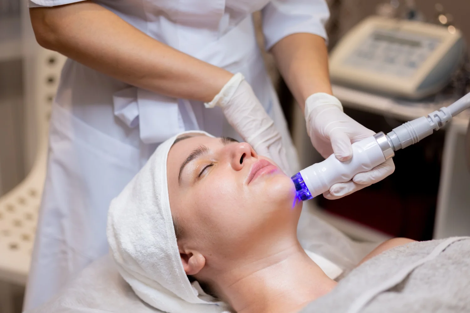 Micro Needling Radiofrequency