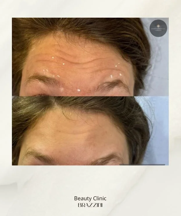 Treatment refinement result 1