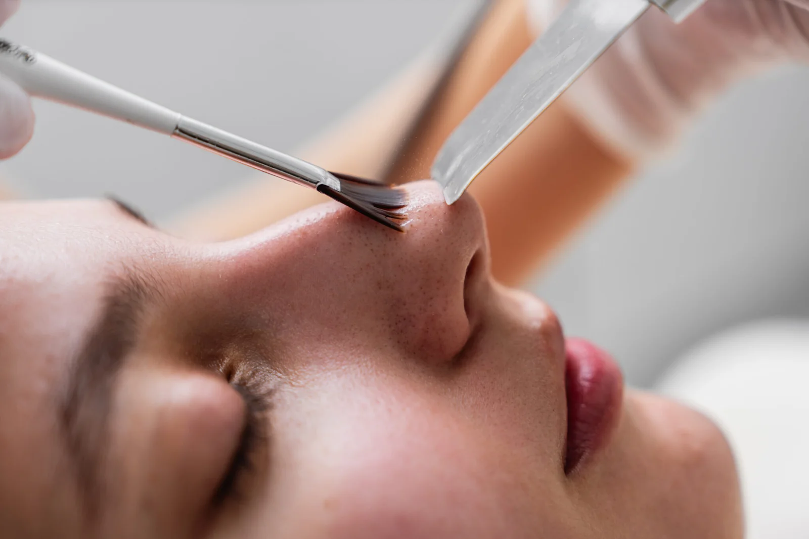 Blemish removal close-up