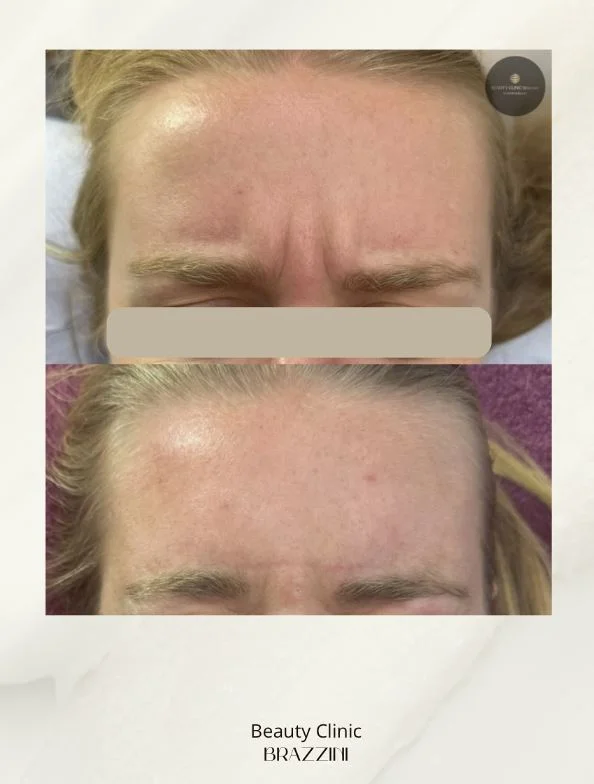 Before and after treatment result 1